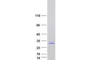 Validation with Western Blot