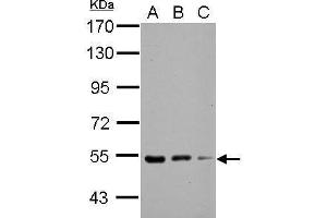 WB Image Sample (30 ug of whole cell lysate) A: NIH-3T3 B: JC C: BCL-1 7. (KBTBD4 anticorps  (Center))