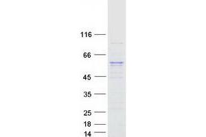 Validation with Western Blot