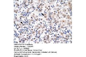 Immunohistochemistry with Human Liver cell lysate tissue (IRF8 anticorps  (N-Term))