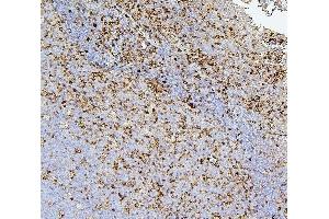 IHC analysis of CD43 using anti-CD43 antibody (ABIN7601042). (CD43 anticorps  (AA 272-400))
