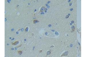 Detection of TNFR1 in Human Brain Tissue using Polyclonal Antibody to Tumor Necrosis Factor Receptor 1 (TNFR1)