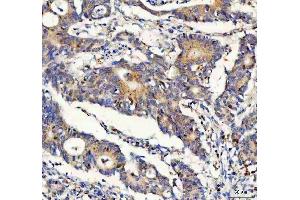 IHC analysis of FOXO3A using anti-FOXO3A antibody (ABIN3042404). (FOXO3 anticorps  (AA 471-673))