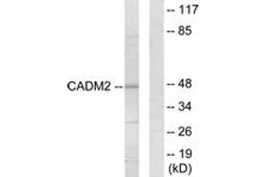 Western Blotting (WB) image for anti-Cell Adhesion Molecule 2 (CADM2) (AA 131-180) antibody (ABIN2889890) (CADM2 anticorps  (AA 131-180))