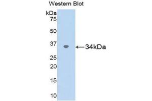 Western blot analysis of the recombinant protein. (SPARC anticorps  (AA 18-301))