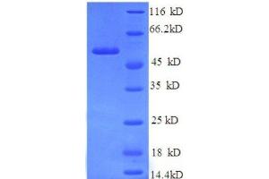 Protein expressed in E.