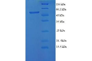 SDS-PAGE (SDS) image for Mesothelin (MSLN) (AA 298-600), (cleaved) protein (His-SUMO Tag) (ABIN5709971)