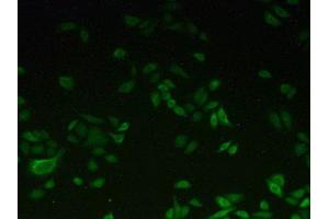 IHC-P analysis of Human HeLa cells, with FITC staining. (CYP1A2 anticorps  (AA 192-444))