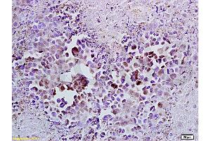 Formalin-fixed and paraffin embedded mouse lymphoma tissue labeled with Anti-Cyclin A2 Polyclonal Antibody (ABIN670281), Unconjugated at 1:100, followed by conjugation to the secondary antibody and DAB staining (Cyclin A anticorps  (AA 375-431))