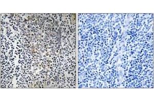 Immunohistochemistry analysis of paraffin-embedded human tonsil tissue, using RPL23 Antibody. (RPL23 anticorps  (AA 51-100))