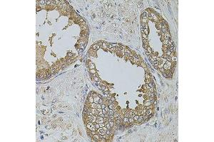 Immunohistochemistry of paraffin-embedded human prostate using KTN1 antibody. (KTN1 anticorps  (AA 1-100))