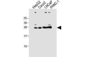 All lanes : Anti-GSTA1 Antibody at 1:4000 dilution Lane 1: HepG2 whole cell lysate Lane 2: Caco2 whole cell lysate Lane 3: LNCaP whole cell lysate Lane 4: NC-1 whole cell lysate Lysates/proteins at 20 μg per lane. (GSTA1 anticorps)