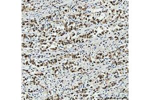 IHC analysis of PC4/SUB1 using anti-PC4/SUB1 antibody (ABIN7602185). (SUB1 anticorps  (AA 62-127))