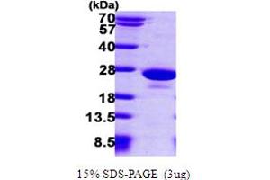 SDS-PAGE (SDS) image for Protein Tyrosine Phosphatase Type IVA, Member 1 (PTP4A1) (AA 1-170) protein (His tag) (ABIN666803)
