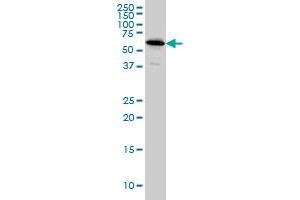 NDOR1 monoclonal antibody (M01A), clone 3A11 Western Blot analysis of NDOR1 expression in HeLa . (NDOR1 anticorps  (AA 498-595))