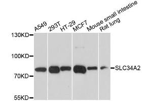 Western blot analysis of extracts of various cell lines, using SLC34A2 antibody. (SLC34A2 anticorps)