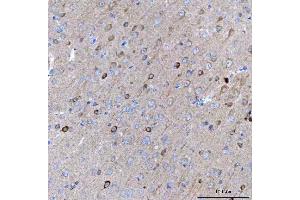 IHC analysis of BCAT1 using anti-BCAT1 antibody (ABIN7602594). (BCAT1 anticorps  (AA 88-386))