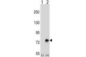 Western blot analysis of TGFBI (arrow) using rabbit polyclonal TGFBI Antibody (N-term) . (TGFBI anticorps  (N-Term))
