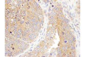 Immunohistochemistry (IHC) image for anti-Septin 7 (SEPT7) (AA 387-437) antibody (ABIN7455012)