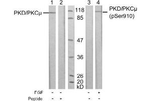 Image no. 1 for anti-Protein Kinase D1 (PRKD1) (pSer910) antibody (ABIN196785) (PKC mu anticorps  (pSer910))