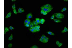 Immunofluorescence staining of HepG2 cells with ABIN7168811 at 1:400, counter-stained with DAPI.