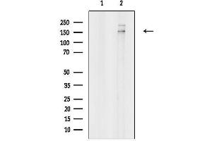 Western blot analysis of lysates from Raji cells(UV treatment), using NMDAR2A Antibody.