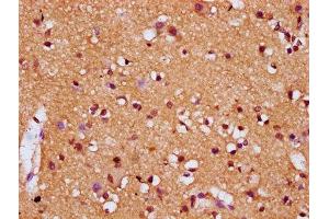 IHC image of ABIN7154582 diluted at 1:200 and staining in paraffin-embedded human brain tissue performed on a Leica BondTM system.