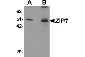 Western Blotting (WB) image for anti-Solute Carrier Family 39 (Zinc Transporter), Member 7 (SLC39A7) (N-Term) antibody (ABIN1031683)