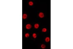 ABIN6278212 staining HepG2 by IF/ICC.