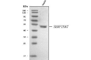 Western blot analysis of Thyroxine Binding Globulin/SERPINA7 using anti-Thyroxine Binding Globulin/SERPINA7 antibody (ABIN7602019). (SERPINA7 anticorps  (AA 55-389))