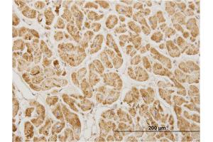 Immunoperoxidase of monoclonal antibody to NDUFA5 on formalin-fixed paraffin-embedded human heart. (NDUFA5 anticorps  (AA 1-116))