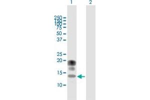 Western Blot analysis of KCNE1 expression in transfected 293T cell line by KCNE1 MaxPab polyclonal antibody.