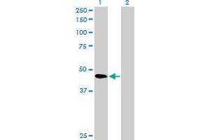 Western Blot analysis of SERPINB2 expression in transfected 293T cell line by SERPINB2 MaxPab polyclonal antibody. (SERPINB2 anticorps  (AA 1-415))