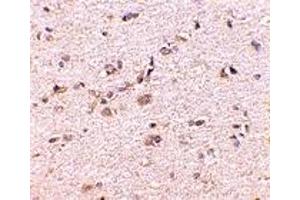 Immunohistochemistry (IHC) image for anti-Discs, Large (Drosophila) Homolog-Associated Protein 1 (DLGAP1) (Middle Region) antibody (ABIN1031076) (DLGAP1 anticorps  (Middle Region))