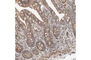 Immunohistochemical staining of human colon with SLC6A7 polyclonal antibody  shows moderate cytoplasmic positivity in glandular cells at 1:20-1:50 dilution.