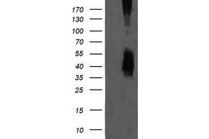Image no. 1 for anti-Mitogen-Activated Protein Kinase Kinase 3 (MAP2K3) antibody (ABIN1499419) (MAP2K3 anticorps)