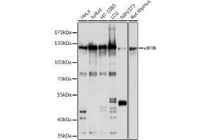 Western blot analysis of extracts of various cell lines, using eIF3B antibody (ABIN6130364, ABIN6140053, ABIN6140054 and ABIN6214441) at 1:1000 dilution. (EIF3B anticorps  (AA 100-350))