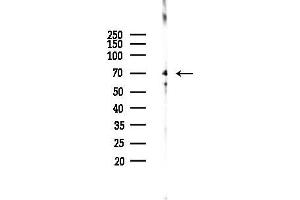 anti-Myeloid/lymphoid Or Mixed-Lineage Leukemia 5 (Trithorax Homolog) (MLL5) antibody
