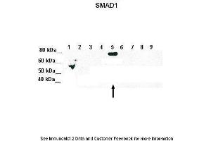 Lanes:   Lane 1: 5ug of transfected 293T lysate (SMAD1)  Lane 1: 5ug of transfected 293T lysate (SMAD2)  Lane 1: 5ug of transfected 293T lysate (SMAD3)  Lane 1: 5ug of transfected 293T lysate (SMAD4)  Lane 1: 5ug of transfected 293T lysate (SMAD5)  Lane 1: 5ug of transfected 293T lysate (SMAD6)  Lane 1: 5ug of transfected 293T lysate (SMAD7)  Lane 1: 5ug of transfected 293T lysate (SMAD8)  Lane 1: 5ug of transfected 293T lysate (GFP)  Primary Antibody Dilution:   1:1000  Secondary Antibody:   Goat anti-Rabbit IgG HRP Conjugated  Secondary Antibody Dilution:   1:10,000  Gene Name:   SMAD5  Submitted by:   Amanda Urick, Medical College of Wisconsin