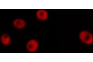 ABIN6267273 staining HeLa by IF/ICC.