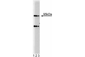 Western blot analysis of Villin on HCT-8 lysate. (Villin 1 anticorps  (AA 1-827))