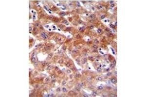 Formalin fixed, paraffin embedded Human liver tissue stained with CYP1A2 Antibody (Center) followed by peroxidase conjugation of the secondary antibody and DAB staining. (CYP1A2 anticorps  (Middle Region))