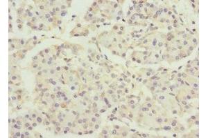 Immunohistochemistry of paraffin-embedded human pancreatic tissue using ABIN7150518 at dilution of 1:100 (DNAJB2 anticorps  (AA 215-324))