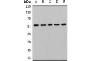 Western blot analysis of HARS2 expression in HepG2 (A), mouse kidney (B), mouse heart (C), rat liver (D), rat brain (E) whole cell lysates. (HARS2 anticorps)