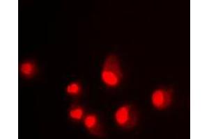 Immunofluorescent analysis of MDM2 staining in Jurkat cells. (MDM2 anticorps  (C-Term))
