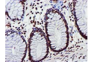 Image no. 9 for anti-Glutathione S-Transferase theta 2 (GSTT2) antibody (ABIN1498553) (GSTT2 anticorps)