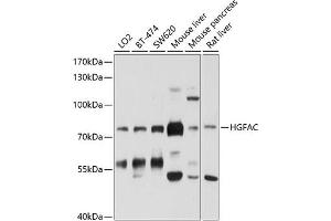 Western blot analysis of extracts of various cell lines, using HGFAC antibody (ABIN6132022, ABIN6141746, ABIN6141747 and ABIN6214246) at 1:1000 dilution. (HGFA anticorps  (AA 408-655))
