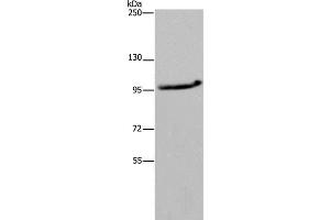 Western Blot analysis of LO2 cell using MAP3K11 Polyclonal Antibody at dilution of 1:400 (MAP3K11 anticorps)