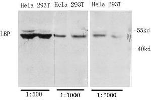 Western Blot (WB) analysis of specific cells using Antibody diluted at 1:1000. (LBP anticorps  (Internal Region))