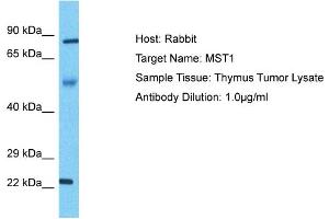 Host: Rabbit Target Name: MST1 Sample Type: Thymus Tumor lysates Antibody Dilution: 1. (MST1 anticorps  (N-Term))